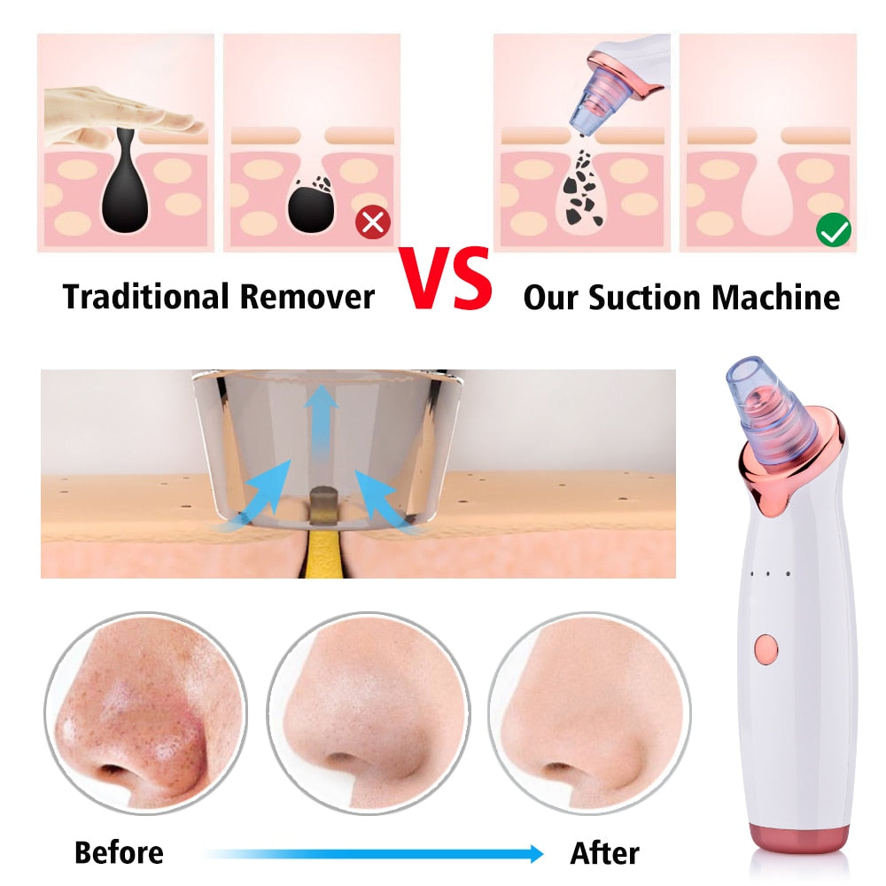Electric blackhead scrubber