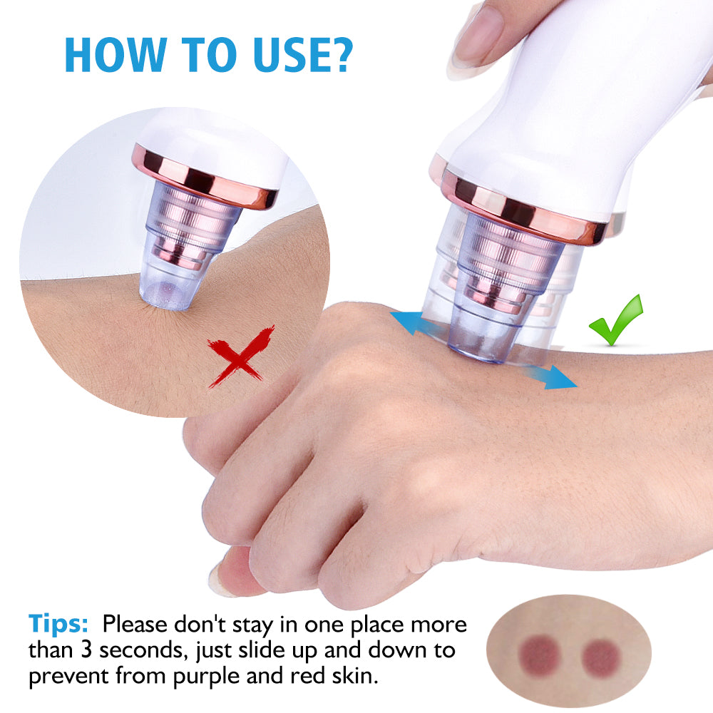 Electric blackhead scrubber