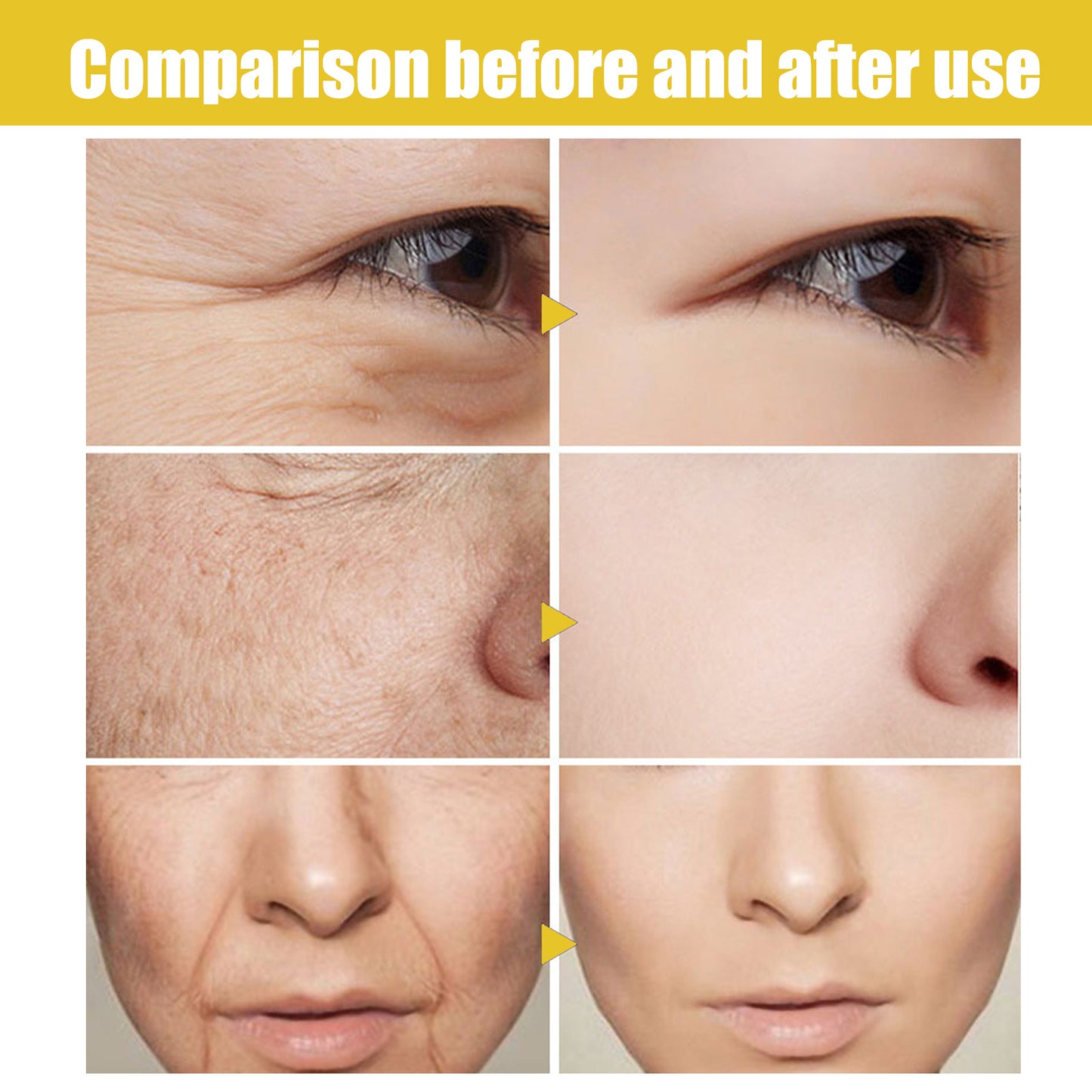 Collagen Fading Wrinkle French Acne Muscle
