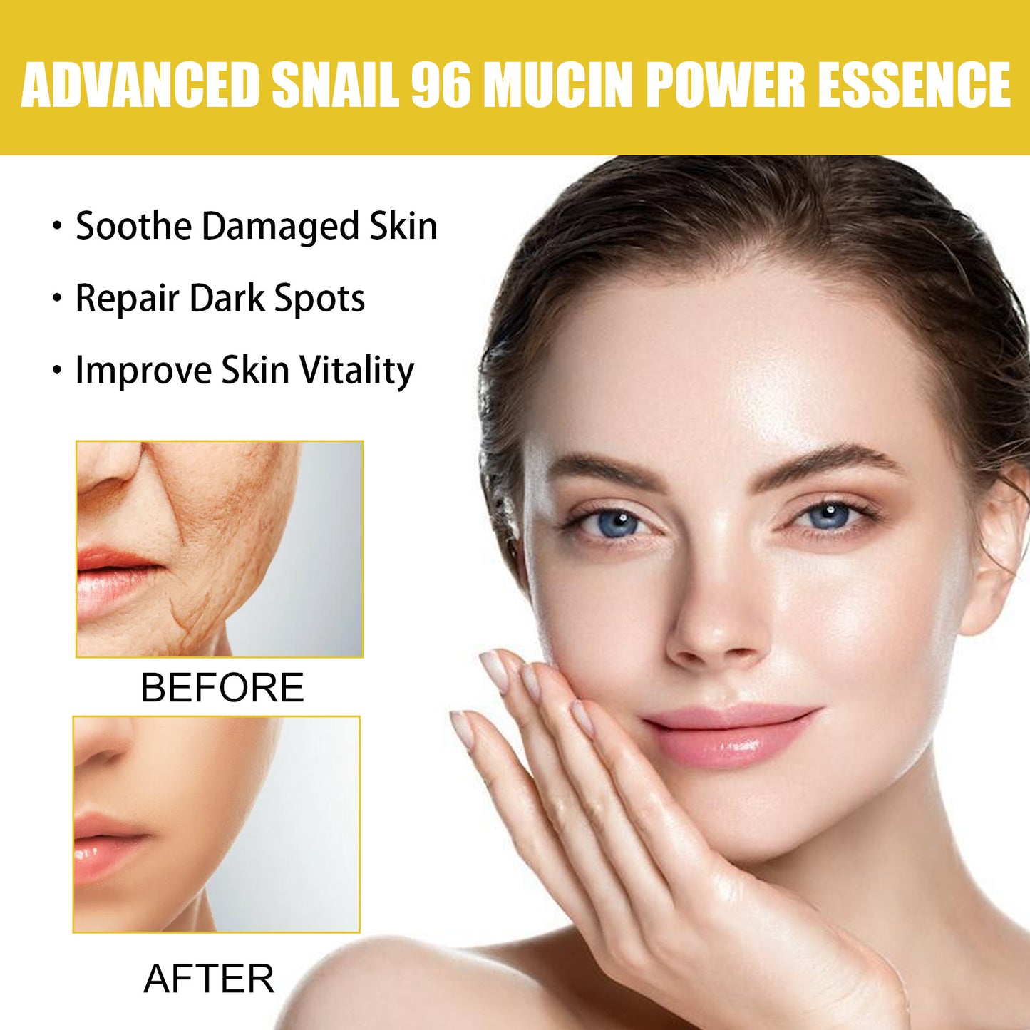 Collagen Fading Wrinkle French Acne Muscle