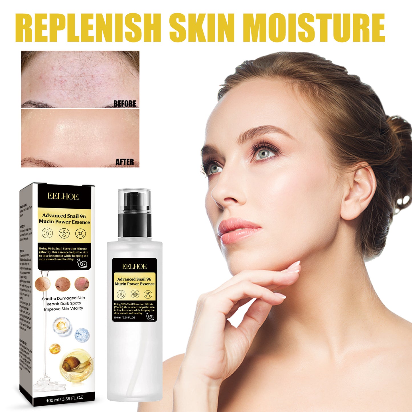 Collagen Fading Wrinkle French Acne Muscle