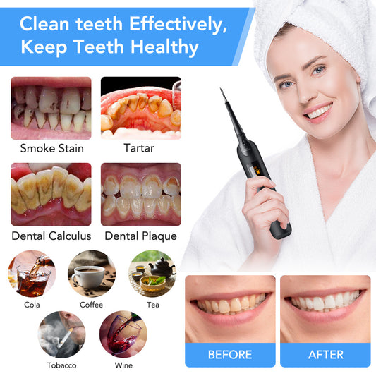 Portable electric tooth cleaner